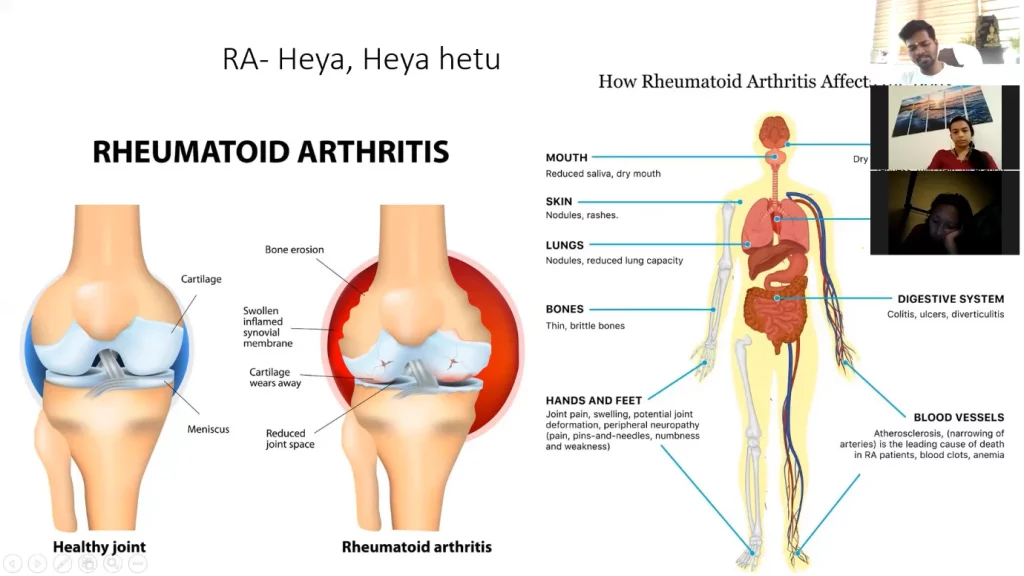 Yoga therapy ttc (level 2)